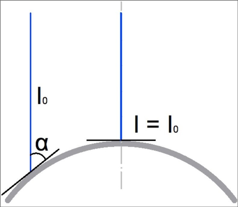 shows the relation between the irradiation intensity of an incident beam and the angle between the irradiated surface and the incident beam demonstrated on a curved surface like the cornea: I(α) = I0.sin(α).
